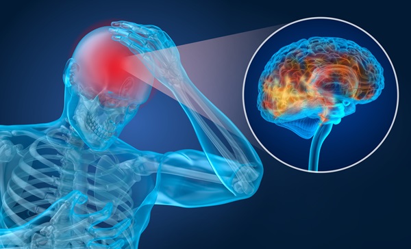 
Gemini said
An anatomical 3D illustration of a transparent human skeleton holding its head in pain, featuring a circular inset showing a detailed, glowing brain scan that highlights a concussion or head injury. (206036422)